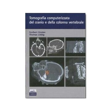 Tomografia computerizzata del cranio e della colonna vertebrale  [Hosten - Edises]