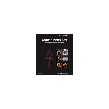 Aortic Diseases -Clinical Diagnostic Imaging Atlas with DVD