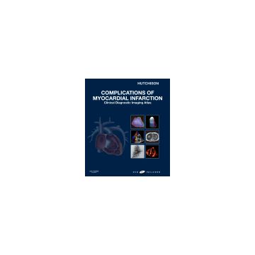 Complications of Myocardial Infarction - Clinical Diagnostic Imaging Atlas with DVD