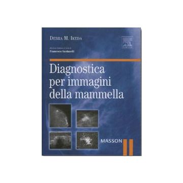 Diagnostica per Immagini della Mammella [Ikeda - Elsevier Masson]