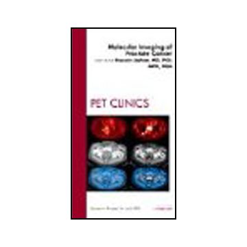Molecular Imaging of Prostate Cancer, An Issue of PET Clinics Volume 4-2