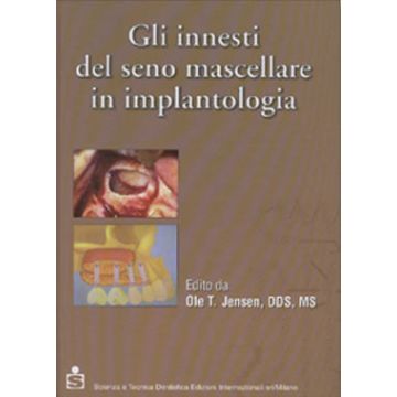 Gli innesti del seno mascellare in implantologia