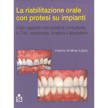 La riabilitazione orale con protesi su impianti - In relazione con estetica, occlusione, ATM, ortodonzia, fonetica e laboratorio