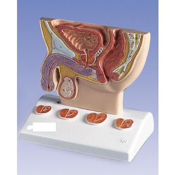 Modello di prostata, ½ grandezza naturale 