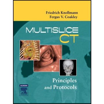 Multislice CT  - Principles and Protocols  [Knollmann; Coakley - Elsevier Science]