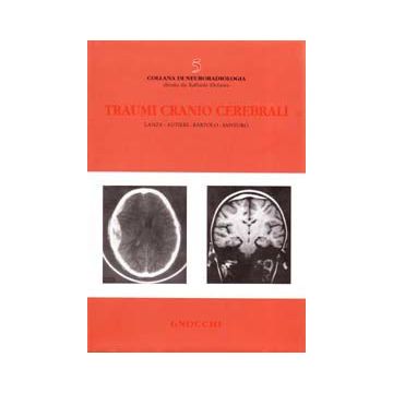 Traumi cranio cerebrali