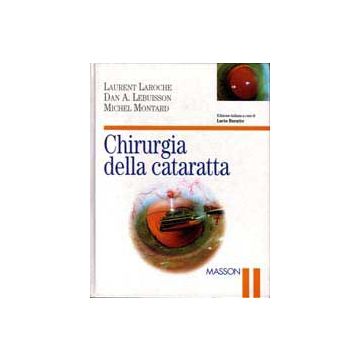 Chirurgia della cataratta