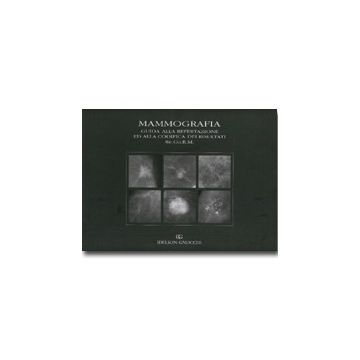 Mammografia. Guida alla refertazione ed alla codifica dei risultati RE.CO.R.M.  [Lattanzio, Simonetti - Idelson - Gnocchi]