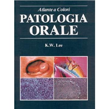 Patologia orale - Atlante a colori