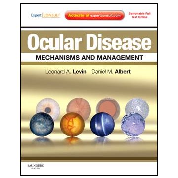 Ocular Disease: Mechanisms and Management - Expert Consult - Online and Print