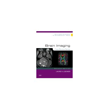Brain Imaging, 2nd Edition - Case Review Series