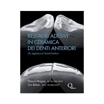 Restauri adesivi in ceramica dei denti anteriori. Concetto di Biomimetica