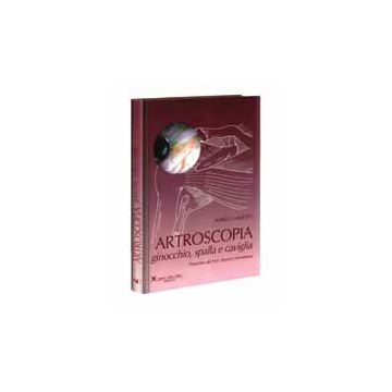 ARTROSCOPIA Ginocchio, spalla e caviglia