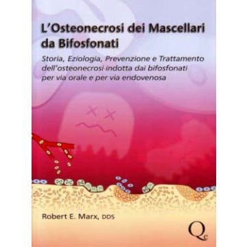 L'Osteonecrosi dei Mascellari da Bifosfonati - Storia, Eziologia, Prevenzione e Trattamento dell'osteonecrosi indotta dai bifosfonati per via orale e per via endovenosa