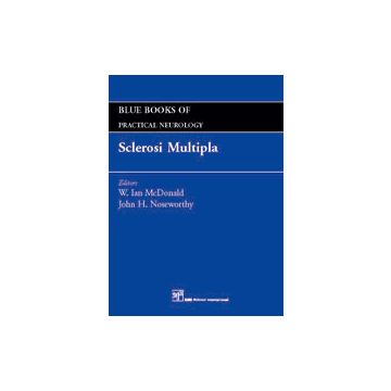 Sclerosi Multipla