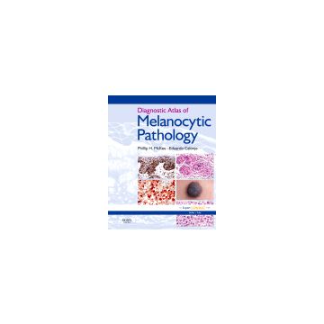 Diagnostic Atlas of Melanocytic Pathology - Expert Consult: Online and Print