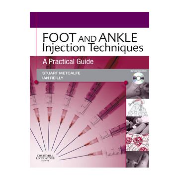 Foot and Ankle Injection Techniques  -A Practical Guide