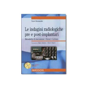 Le indagini radiologiche pre e post-implantari. Metodiche di esecuzione, errori, lettura + CD