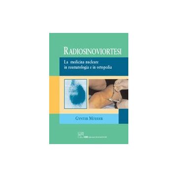 RADIOSINOVIORTESI La medicina nucleare in reumatologia e in ortopedia