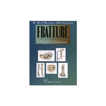 FRATTURE Diagnosi e trattamento