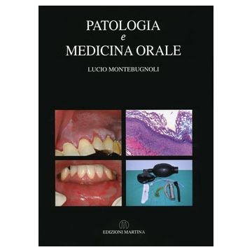 Patologia e Medicina Orale [Montebugnoli - Martina Edizioni]