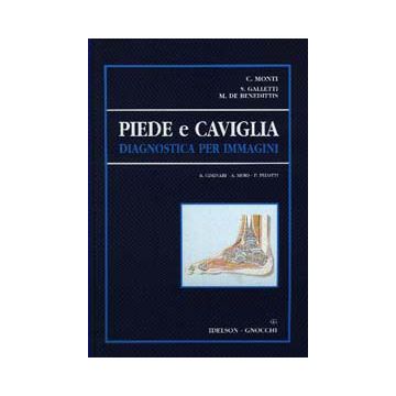 Piede e caviglia. Diagnostica per immagini