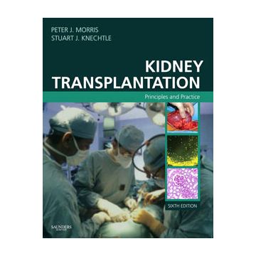Kidney Transplantation, 6th Edition - Principles and Practice
