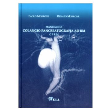 Manuale di COLANGIO PANCREATOGRAFIA AD RM  CPRM
