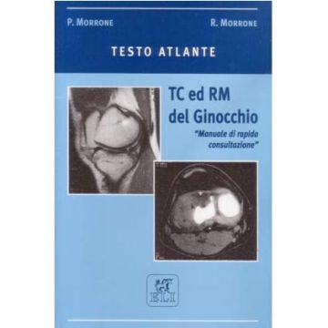 TC e RM del Ginocchio - Testo Atlante - Manuale di rapida consultazione