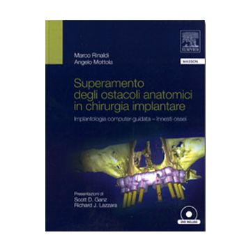 Superamento degli ostacoli anatomici in Chirurgia Implantare - Implantologia Computer-Guidata - Innesti ossei + DVD