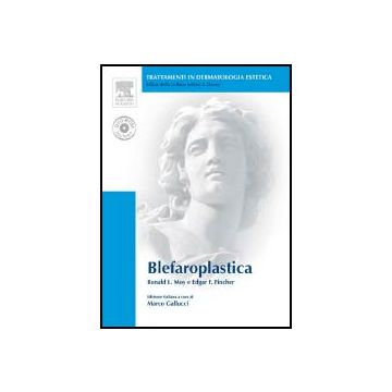 Blefaroplastica + DVD  [Moy Fincher - Elsevier Masson]