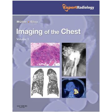 Imaging of the Chest, 2-Volume Set -Expert Radiology Series
