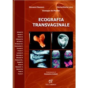 Ecografia Transvaginale