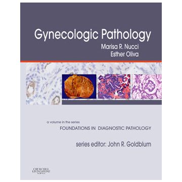 Gynecologic Pathology  - A Volume in Foundations in Diagnostic Pathology Series