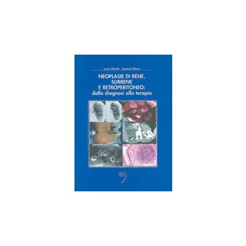 Neoplasie di Rene, Surrene e Retroperitoneo: dalla diagnosi alla terapia
