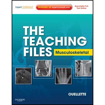The Teaching Files: Musculoskeletal  - Expert Consult - Online and Print