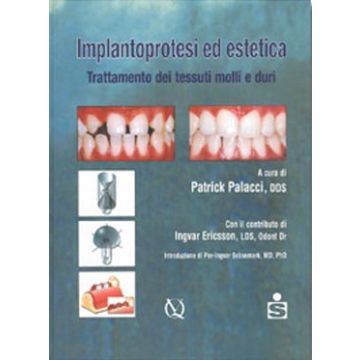 Implantoprotesi ed estetica - Trattamento dei tessuti molli e duri