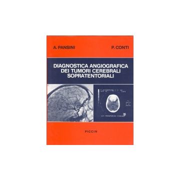 Diagnostica angiografica dei tumori cerebrali sopra-tentoriali