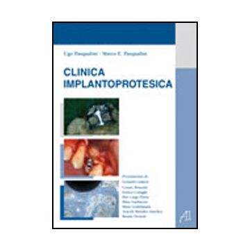 Clinica Implantoprotesica