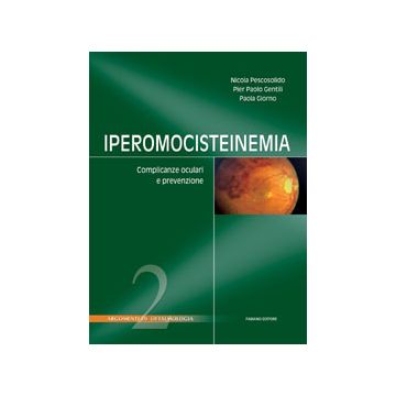 IPEROMOCISTEINEMIA - Complicanze oculari e prevenzione