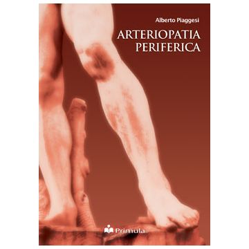 Arteriopatia periferica