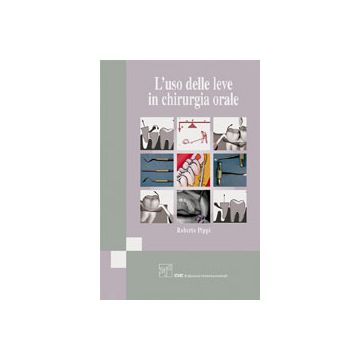 L'uso delle leve in chirurgia orale - Pippi Roberto - Cic Edizioni