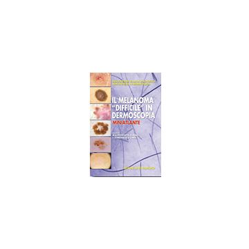 Il melanoma ''difficile'' in dermoscopia  [Pizzichetta - Minerva Medica]