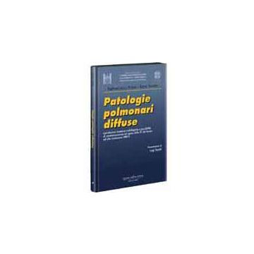 Patologie Polmonari Diffuse [Podda; Santini - Delfino Editore]