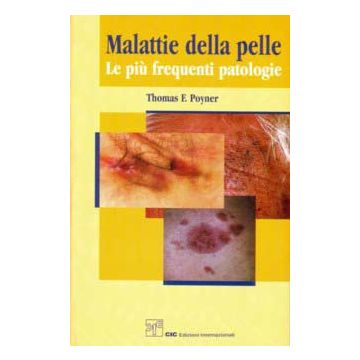 MALATTIE DELLA PELLE. Le più  frequenti patologie  