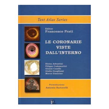 Le Coronarie viste dall'interno