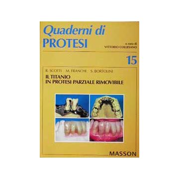 Il titanio in protesi parziale rimovibile - n. 15 (Quaderni di protesi)
