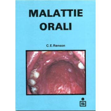 Malattie orali - Atlante a colori