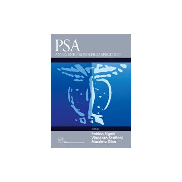 PSA - Antigene Prostatico Specifico