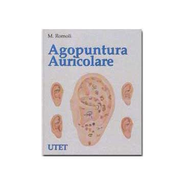 Agopuntura auricolare